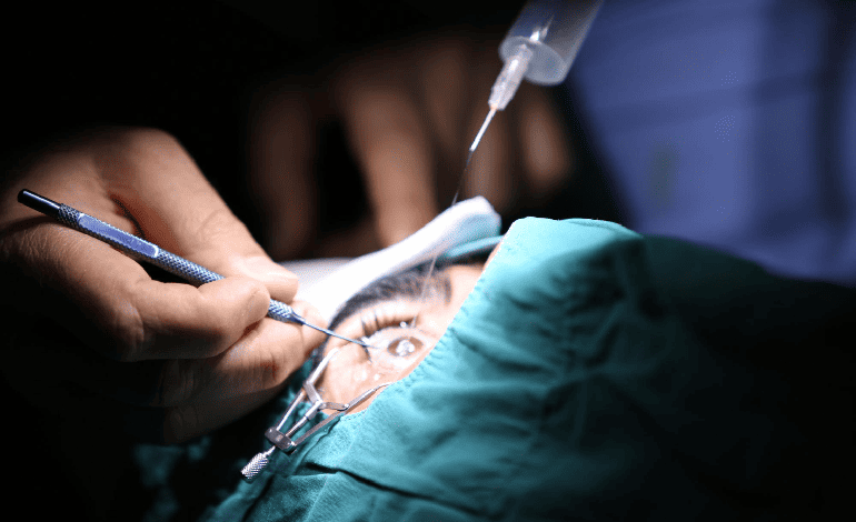 Cirugía de implante de lente secundario en Monterrey: Solución avanzada en Oftalmología