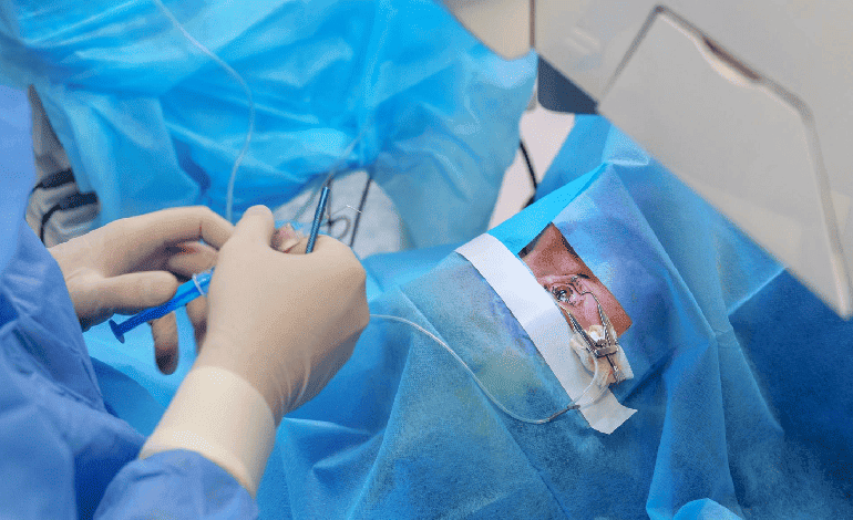 Cirugía para retirar flotadores en Monterrey: Solución Innovadora en Oftalmología