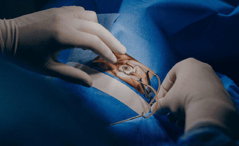 Neumorretinopexia en Monterrey: Innovación en Oftalmología para Desprendimientos de Retina